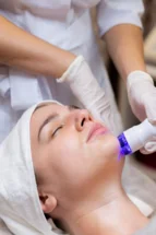 limpieza facial en lima